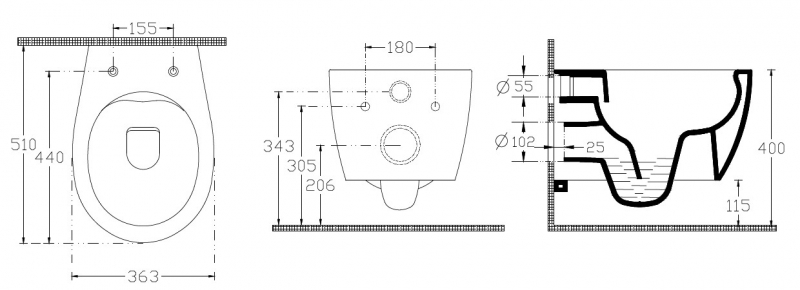 Подвесной унитаз Allen Brau Fantasy  с сиденьем в комплекте, бежевый 51*36