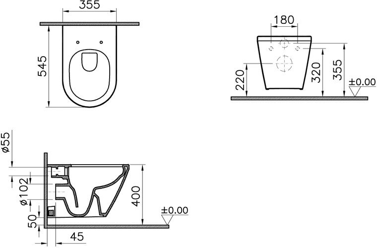 Комплект Vitra Interga Round L-box инсталляция с клавишей смыва, унитазом и сиденьем с микролифтом