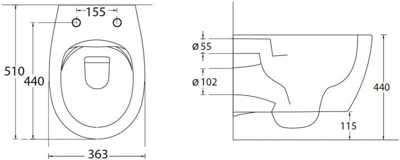 Подвесной унитаз Allen Brau Fantasy 4.11004.20 51x36,3 сиденье Duroplast, Soft-Close, белый